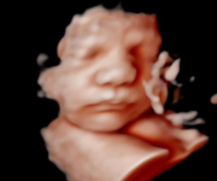 Ultrasound image